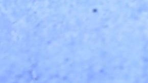 Galilea Montijo se fracturó el pie izquierdo | Mezcalent