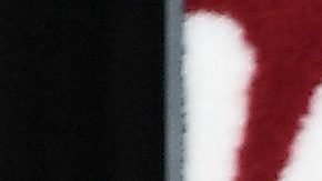 Anya Taylor-Joy ha sufrido racismo y bullying en su vida