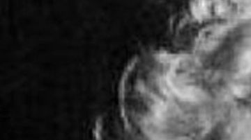 Luis Miguel