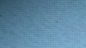 Juan Pablo Medina tiene trombosis venosa | Mezcalent