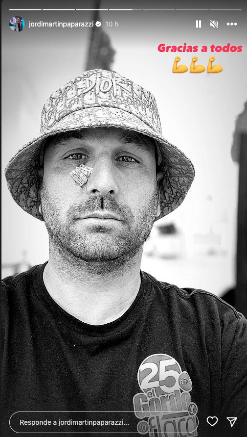 Jordi Martín, reportero de El gordo y la flaca, operado de urgencia: "Me detectaron un carcinoma"