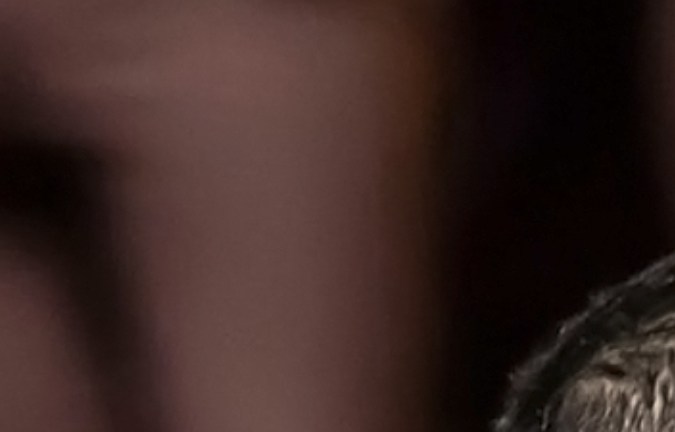 Así luce el rostro de Christian Nodal tras aplicarse tratamiento para retirar los tatuajes