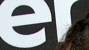 'La Transformación de las Estrellas': El antes y después de Belinda tras 19 cirugías estéticas