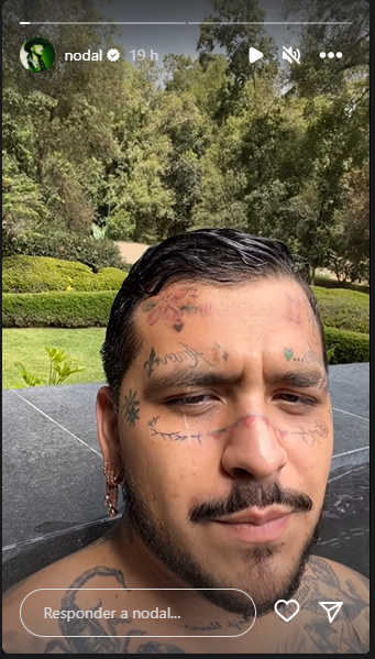 Así luce el rostro de Christian Nodal tras aplicarse tratamiento para retirar los tatuajes