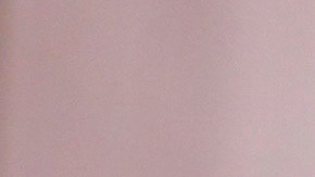 Héctor Sandarti se hizo una cirugía estética en el rostro