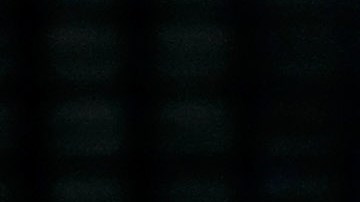 Luis Miguel sufrió un percance en un concierto