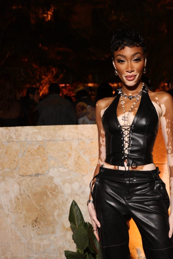 Winnie Harlow. Foto: World Red Eye. 