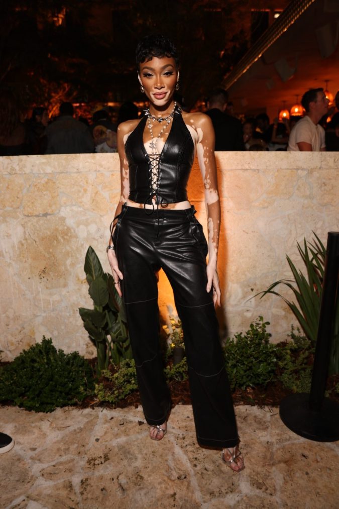 Winnie Harlow. Foto: World Red Eye.