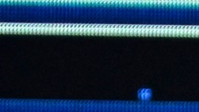 Bad Bunny se arrepiente de un procedimiento estético