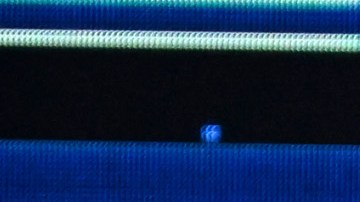 Bad Bunny se arrepiente de un procedimiento estético