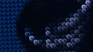 Celine Dion sufre una dolorosa enfermedad