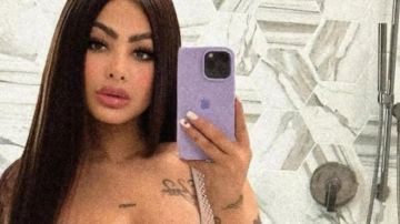 Yailin La Más Viral revela la razón de sus golpes, sufrió accidente con Tekashi 6ix9ine