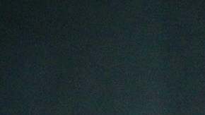 ¡Todo por ganar! Alfredo Adame se realizó unos “retoques” estéticos antes de ‘La Casa de los Famosos’