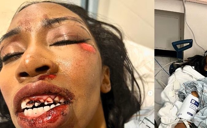 Carrie Boseman, actriz de Black Panther, fue arrollada en Año Nuevo