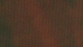 Camila Sodi sufre una conmoción cerebral: ¿Qué es y cuál es el estado de salud de la actriz?