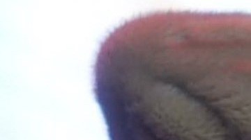 Belinda se recupera de una cirugía.