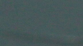 Kate Middleton tuvo una cirugía abdominal en enero de 2024 de la que se tienen pocos detalles