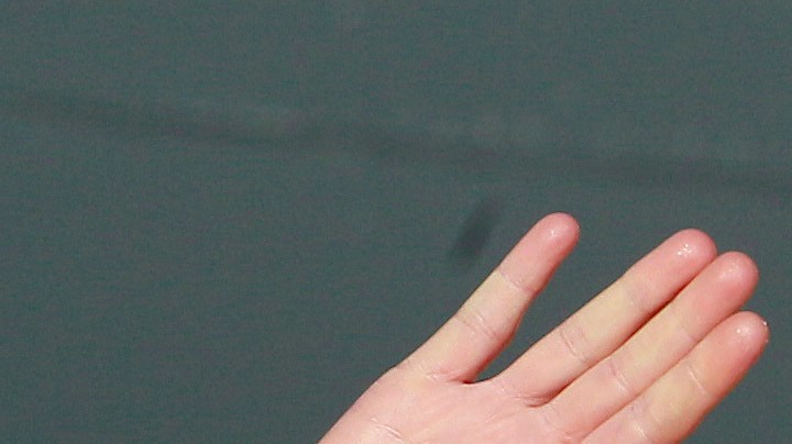 Kate Middleton tuvo una cirugía abdominal en enero de 2024 de la que se tienen pocos detalles