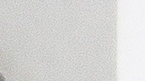 Kate Middleton se recupera de una cirugía en medio de muchas especulaciones.