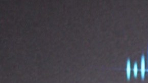 Anuel AA se borra los tatuajes de sus ex parejas.