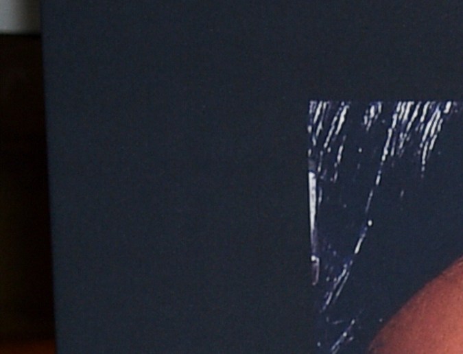 Rihanna asegura que tiene planeada una cirugía tras sus embarazos.