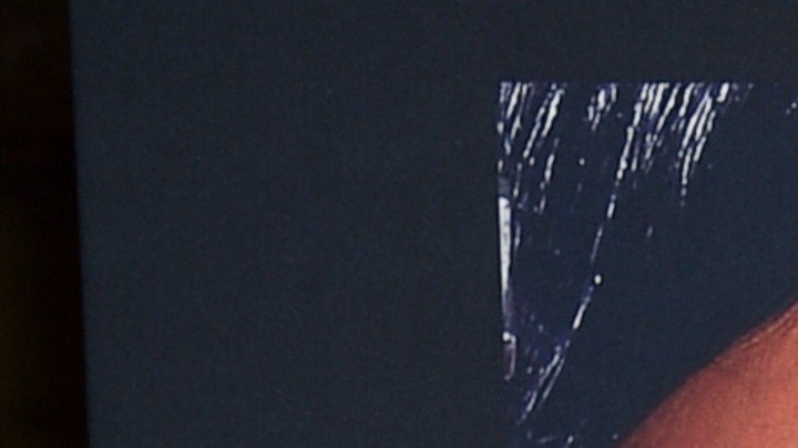 Rihanna asegura que tiene planeada una cirugía tras sus embarazos.