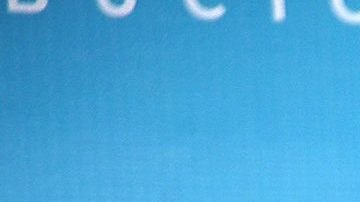 Verónica Castro fue sometida a una cirugía de emergencia.