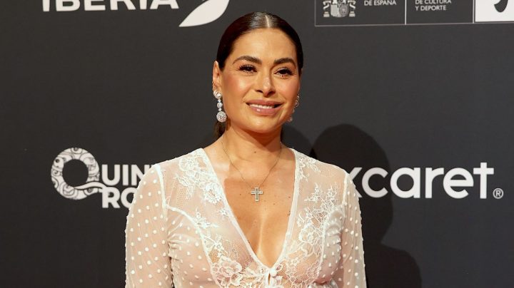 Galilea Montijo sufrió una caída y se lastimó una pierna.