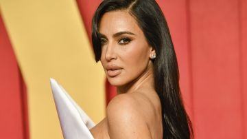 Kim Kardashian comparte un padecimiento con uno de sus hijos.