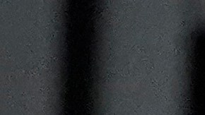 Billie Eilish sufre un grave trastorno.