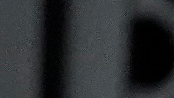 Billie Eilish sufre un grave trastorno.