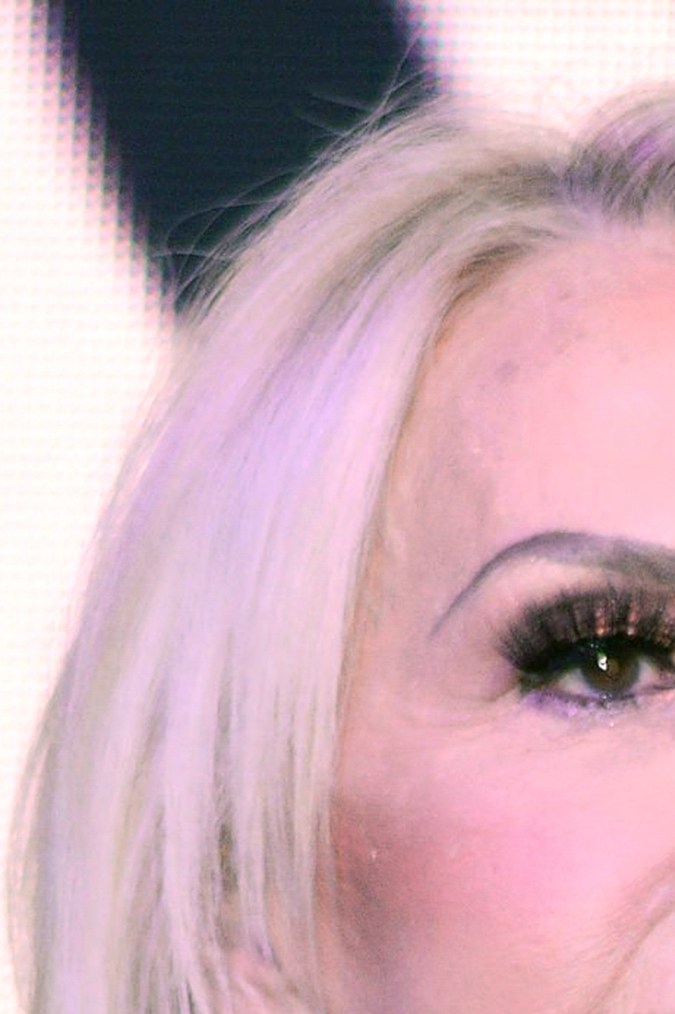 Laura Bozzo se realiza tratamiento estético.