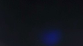 Alejandra Guzmán publicó la foto del golpe que sufrió en el Aeropuerto Internacional de la Ciudad de México.