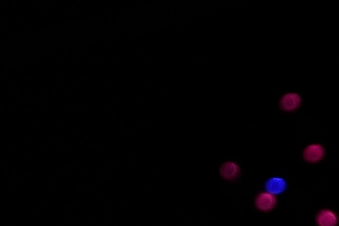 Coldplay Performance