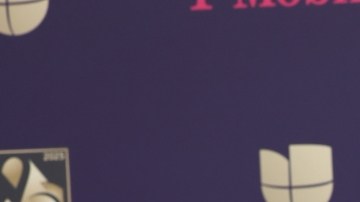 Así quedó la cirugía de senos a la que se sometió Carolina Sandoval.