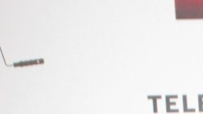 Paulo Quevedo fue diagnosticado con nódulos con apariencia cancerígena.