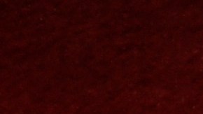 El informe, elaborado por el médico forense Lloyd White﻿ apenas a tan solo tres horas de su partida﻿, describe detalladamente el tipo de heridas que presentó la cantante y que finalmente fueron fatales para su vida. (Photo by Chris Pizzello/Invision/AP).