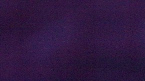 El actor compartió varias imágenes desde la cama de un hospital, donde se le observó tras la operación.