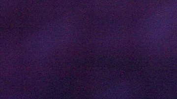 El actor compartió varias imágenes desde la cama de un hospital, donde se le observó tras la operación.