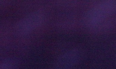 El actor compartió varias imágenes desde la cama de un hospital, donde se le observó tras la operación.