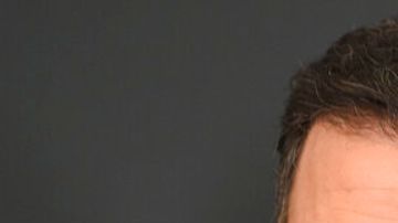 Jimmy Kimmel se burló de la diferencia de edad entre Melania Trump y Donald Trump.