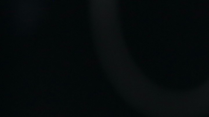 Fue la propia cantante quien dio a conocer la cirugía mediante una foto en el hospital y un largo texto en el que explicó las circunstancias del procedimiento.