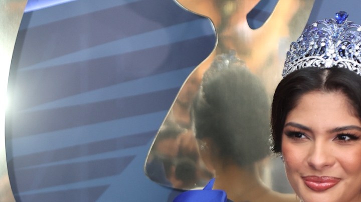 Sheynnis Palacios responde a las dudas sobre su salud tras salir de 'Top Chef VIP 5'.